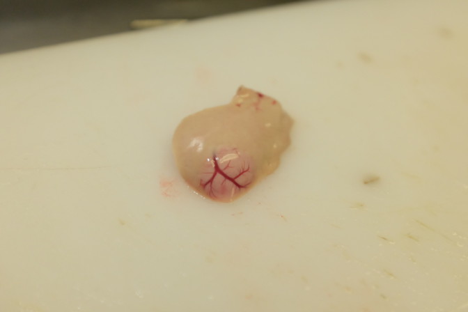 A liver tumour on a common dab