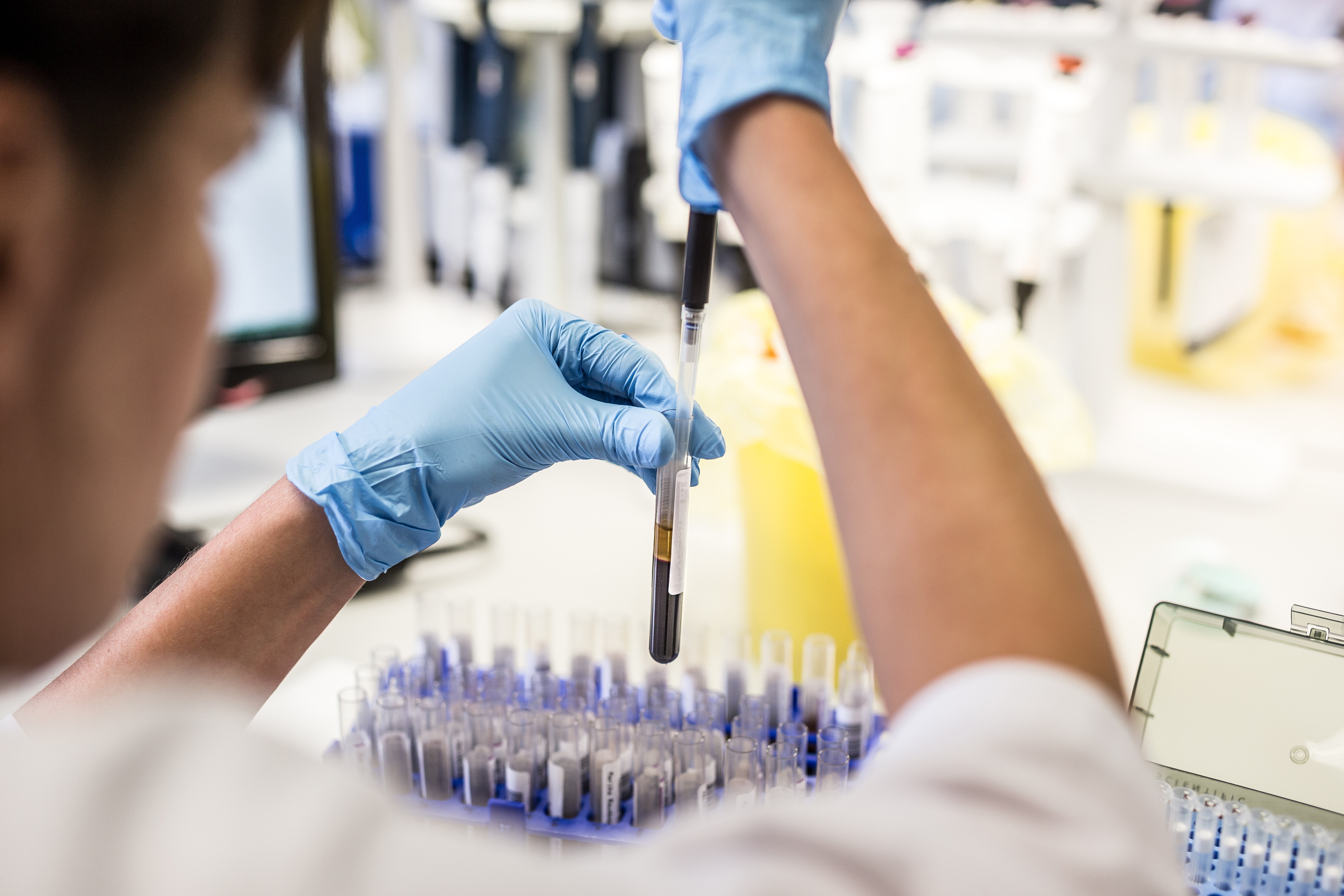 The analysis of copper levels in blood facilitates diagnosis of