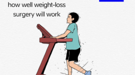 Genes can predict how well weight-loss surgery will work