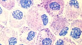 Mast cells may also be involved in infertility, since they are found at high numbers in the mucosal layer of the uterus, i.e. the endometrial tissue. Author: Kauczuk / Wikimedia Commons