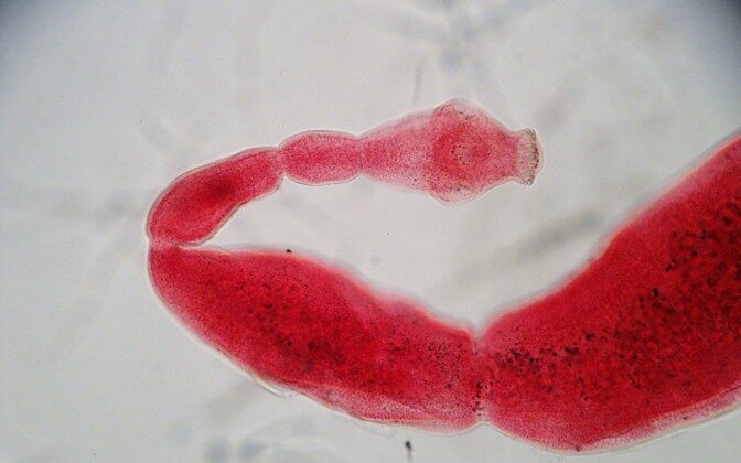 Tapeworm (Echinococcus granulosus). Author/source: Chelsea L. Wood/Flickr