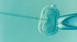 In vitro fertilization (IVF)