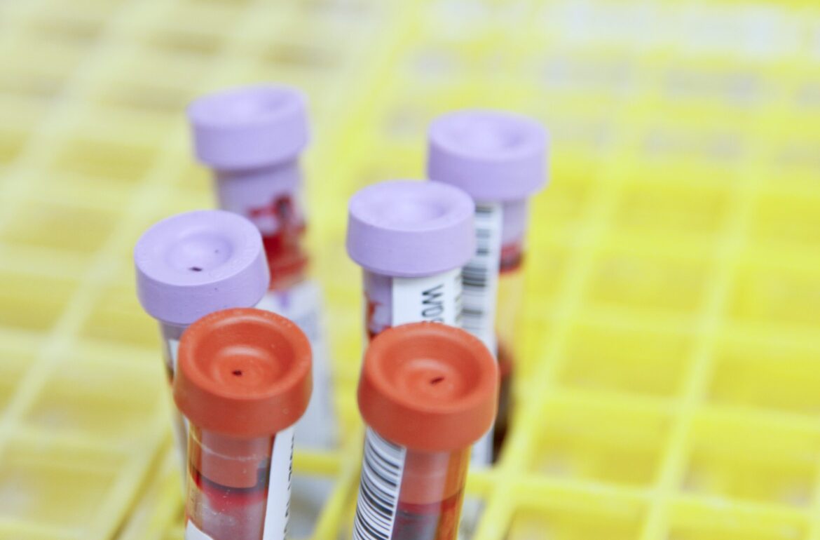 Blood samples. Photo credit: Unsplash, National Cancer Institute
