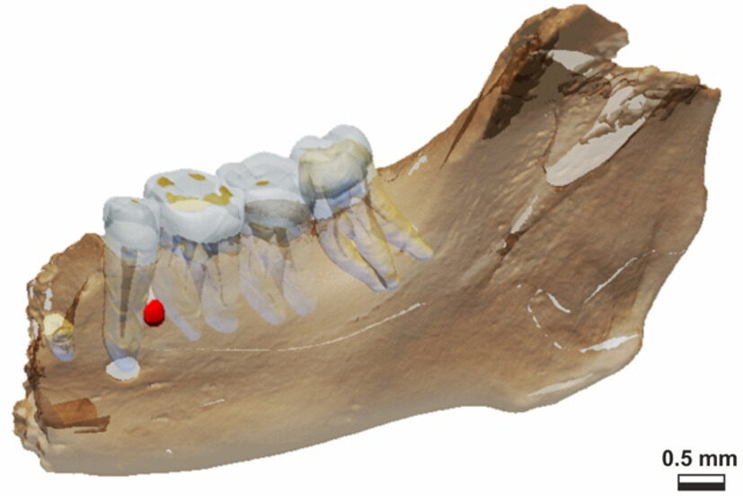 Virtual model of the hemimandible Tagliente2. In the latter, the presenceo of cementoma is visible (in red). Credit: G. Oxilia